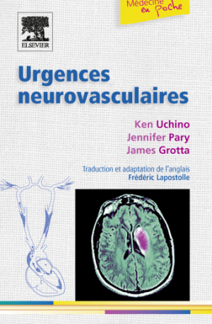 Urgences neurovasculaires